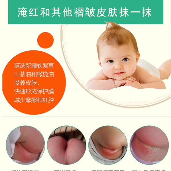 醫(yī)兒樂(lè)嬰兒紫草油新生兒童寶寶淹紅修復(fù)油.jpg