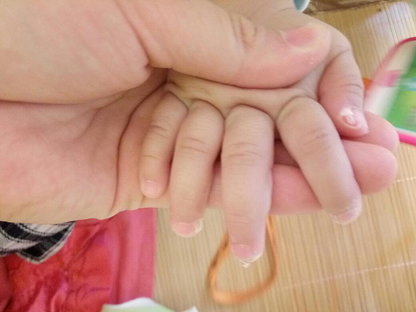 ÓƤôkԇԇ߼ɽo(h)˪ѽ