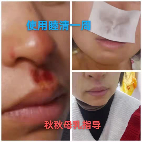 澏NÆM߿ڱaƷȦ۟o(sh)